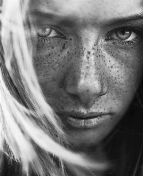 Rays Of The Sun Beautiful Freckles Portrait Freckles