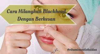 Obat alami menghilangkan kutil secara alami di dharmasraya. Cara Hilangkan Blackhead Dengan Berkesan Menjadikan Muka ...