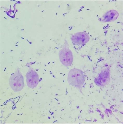 Giardia 🔬😍🐛 Mikrobiyoloji Microbiology Microbiologia Microscope