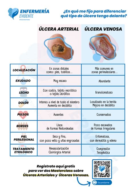 Infografía Diferencia Entre Ulcera Arterial Y Venosa Enfermeria Evidente
