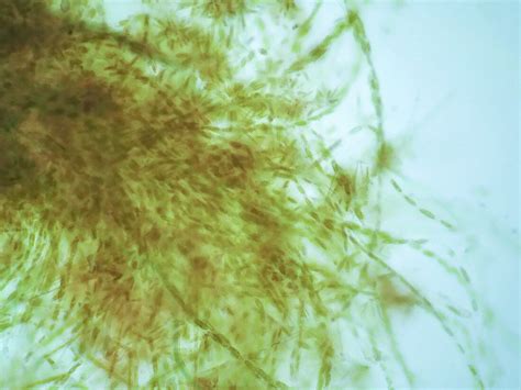 Filamentous Algae Light Micrograph Bild Kaufen 13369495 Science
