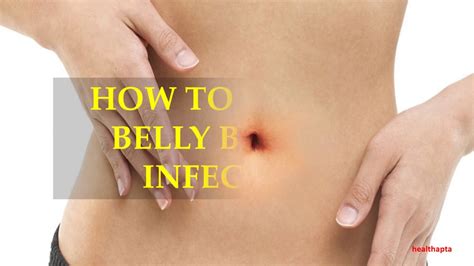 How To Treat A Belly Button Infection Youtube