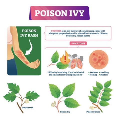 Your Complete Guide To Poison Ivy How To Spot It Prevent It Treat It Mindful Family Medicine