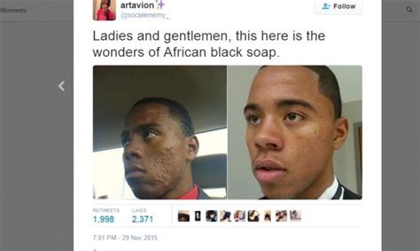 African Black Soap Acne Before And After African Black