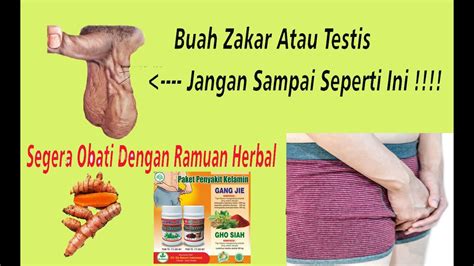 nama obat buah zakar membengkak di apotek terdekat youtube