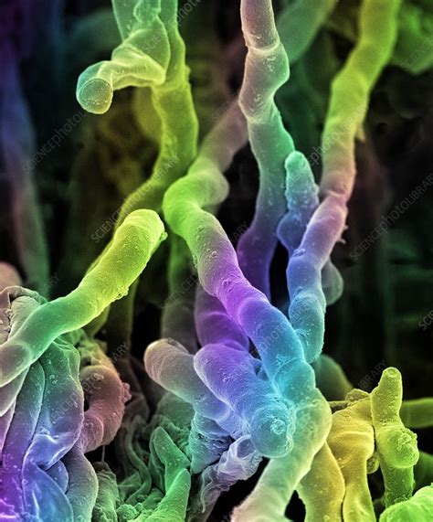Streptomyces Coelicoflavus Bacteria Sem Stock Image F0124021