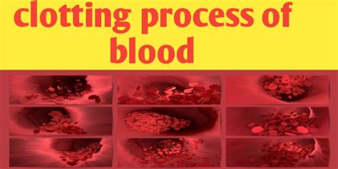 Clotting Process Of Blood And Its Mechanism Biologysir
