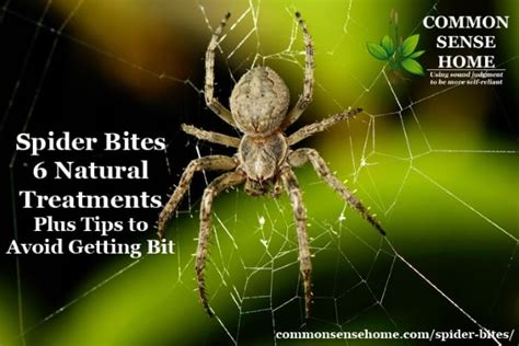 Best Way To Treat A Spider Bite At Home ~ Loedesigns