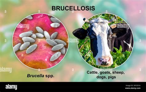 Brucella Bacteria The Causative Agent Of Brucellosis Computer