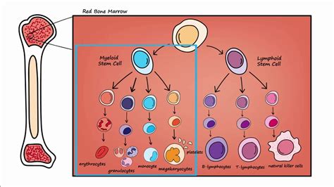 Types Of Leukemia Overview Diagnosis Cancer Stages And Treatment Gambaran