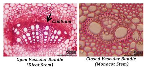 Types Of Vascular Bundles Easybiologyclass