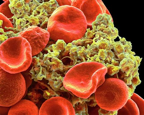 Red Blood Cells And Platelets Photograph By Steve Gschmeissner Fine