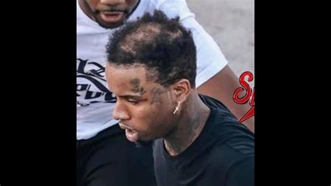 Tory Lanez Gets A Haircut After Being Roasted For Having A Huge Bald Spot On Top Of His Head