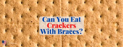 Can You Eat Crackers With Braces Soft And No Sugar Best Orthodontist USA