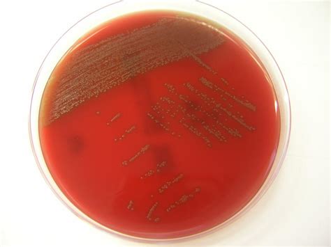 The culture is best done on blood agar plates. Gram-Positive Bacilli (Rods) - Microbiology learning: The "why"ology of microbial testing