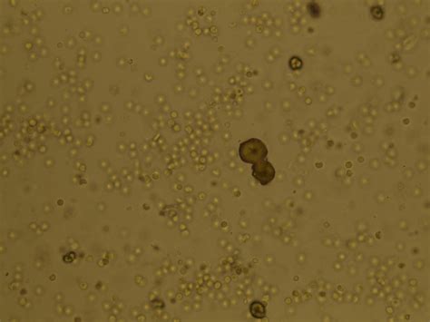 Microscopic Analysis Of Urine Faculty Of Medicine Masaryk University