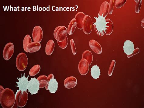 World Cancer Day 2023 What Are Blood Cancers Types Symptoms