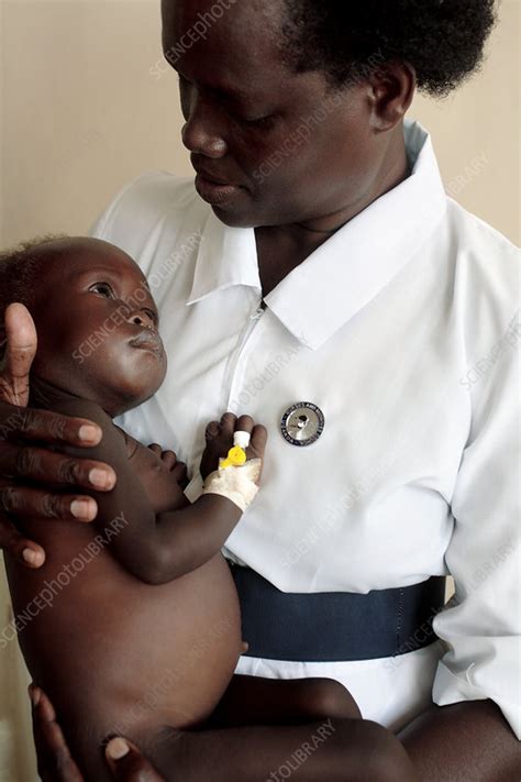 Nurse Holding A Malnourished Baby Stock Image M9350372 Science