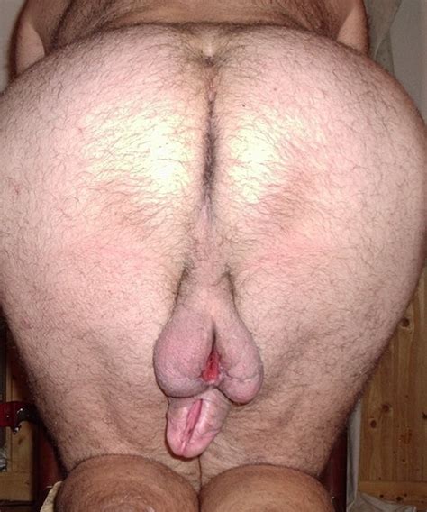 Extreme Modification Of The Penis 85 Pics Xhamster