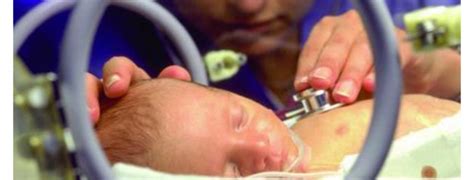 Nueva cirugía para la hidrocefalia en neonatos alternativa a la