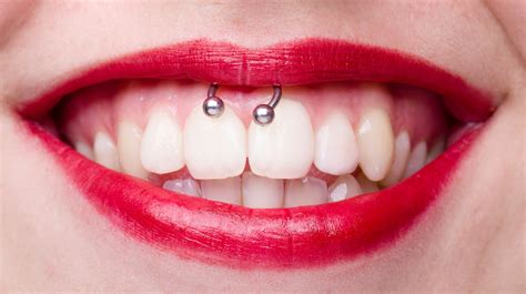 Does A Smiley Piercing Damage Your Teeth
