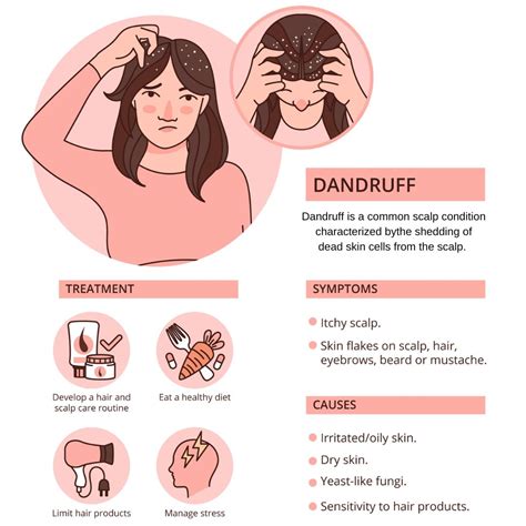 Dandruff Causes Risk Factors Symptoms Treatment