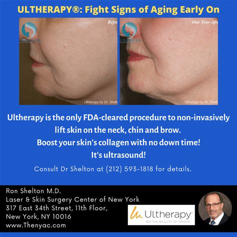 Benefits Of Ultherapy Nyc Non Surgical Treatment To Tighten Facial Tissue