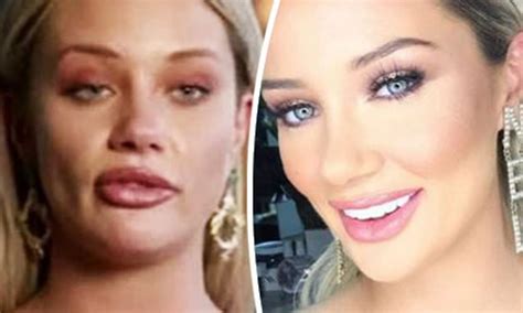 Mafs Jessika Power Has Spent More Than 60000 On Plastic Surgery Daily Mail Online