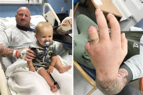 Brit Holiday Horror Dad Loses Two Fingers In Mexico Jungle Buggy