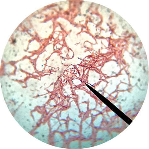 Endospore Stain Definition Techniques Procedures And Significance