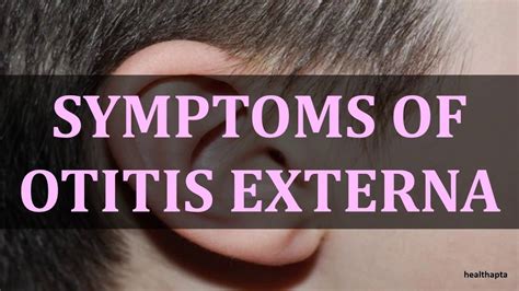 Symptoms Of Otitis Externa Youtube