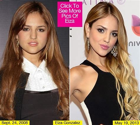 Eiza Gonz Lez Plastic Surgery Before And After Photos Celeblens Com