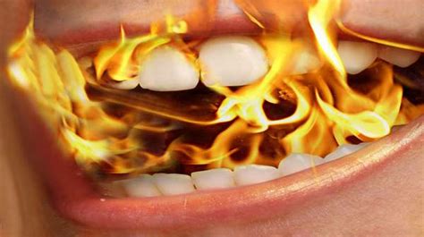 Burning Mouth Syndrome What Is Health Digest