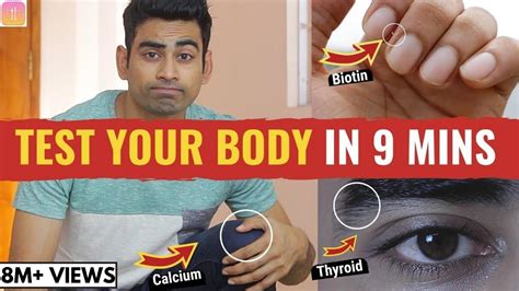 28 Signs Your Body Is Deficient In Vital Nutrients With Solution