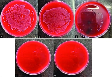 Blood Agar Plate Showing The Cfu Of Enterococcus Faecalis A 05 Wv