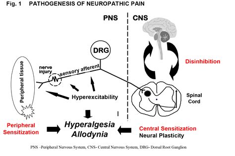 Neuropathic Pain Wfsa Resources