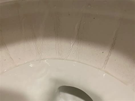 My Toilet Bowl Has Black Dark Marks That Could Not Be Cleaned