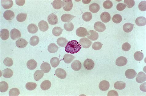 Kostenlose Bild Blutausstrich Enth Lt Microgametocyte Parasiten Plasmodium Vivax
