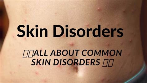 🏥🏥all About Common Skin Disorders 🚑🚑video Drugs For Skin Disorders 🏥🚑