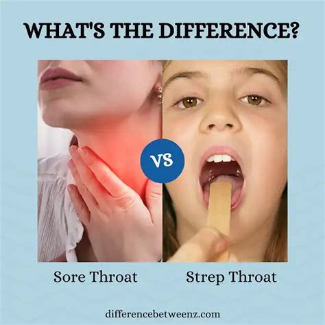 Difference Between Sore Throat And Strep Throat Difference Betweenz