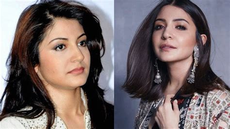 Priyanka Chopra To These Actress Has Undergone Plastic Surgery