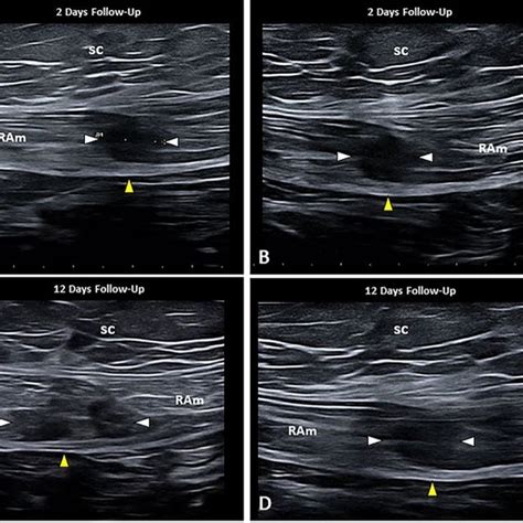 Diagnostic Phase Short A And Long B Axis B Mode Ultrasound Images