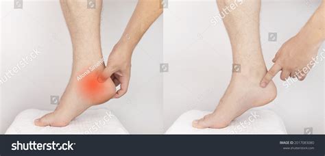 97 Joint Pain Before And After Images Stock Photos And Vectors