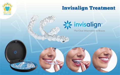 Invisalign Treatment Everything You Need To Know Elite Dental Care