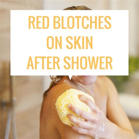 red blotches on your skin after shower skin blotches skin beauty