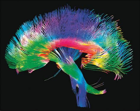 Human Connectome Project Maps Brains Cortex Into 180 Distinct