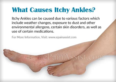 Why My Feet Are Itchy