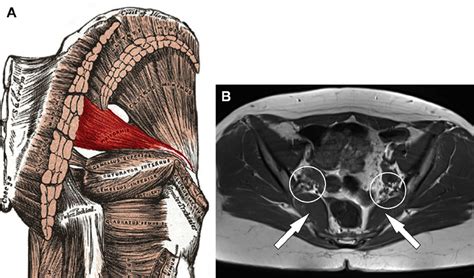 Anatomy Of The Piriformis Muscle A Anatomic Illustration Shows The