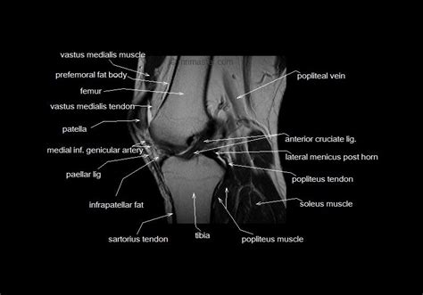 Knee Muscle Anatomy Mri Thigh Muscle Anatomy Mri Anatomía Musculos