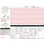 EKG Interpretation Cheat Sheet 1 Rate  Regular GrepMed